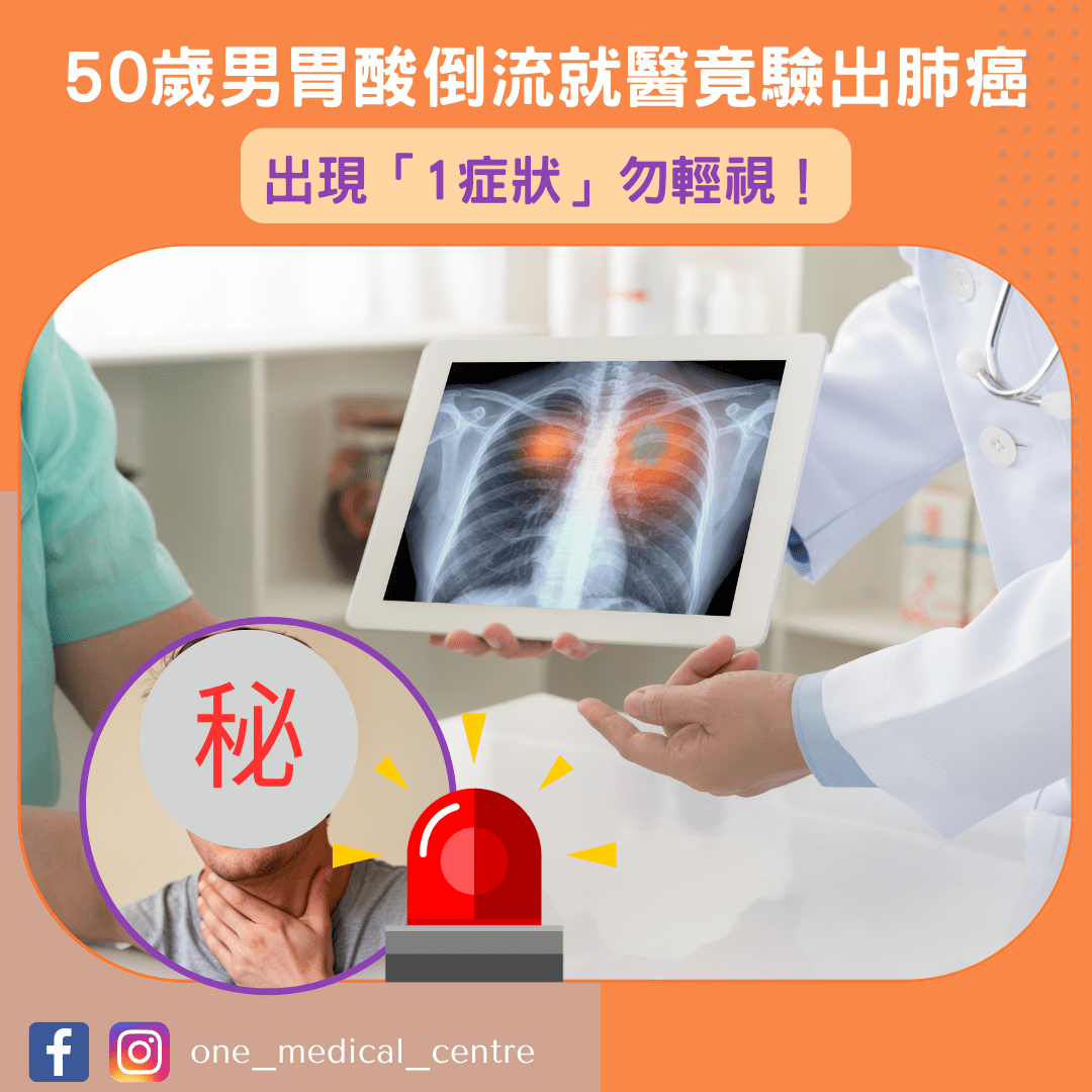 【出現「1症狀」勿輕視！50歲男以為胃酸倒流　就醫竟驗出肺癌】